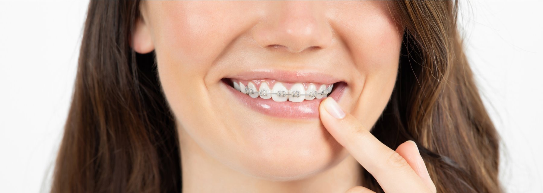 Orthodontic Treatment to transform smiles in New York